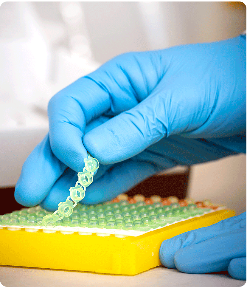 GynTect Strips oncgnostics GmbH Laborsituation: Nahaufnahme von Hand mit Gummihandschuhen, die Deckel von Strips ziehen.
